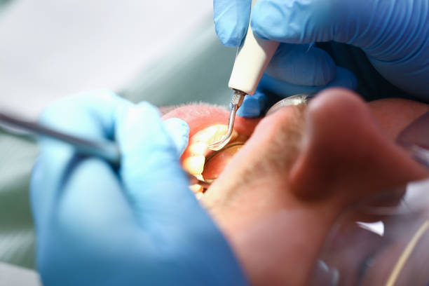 Best Emergency Broken Tooth Repair in Valley, NE